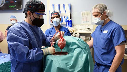 Heart Transplant Surgery2 Heart Transplant Surgery2