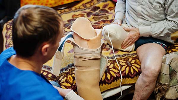 Prosthetist Removes Measure From Person with Disability Man with Amputee 627829 7077